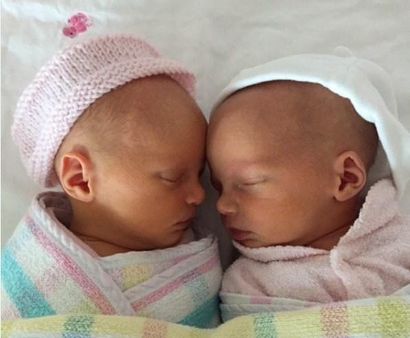 После мальчиков-близнецов женщина родила девочек-близнецов
