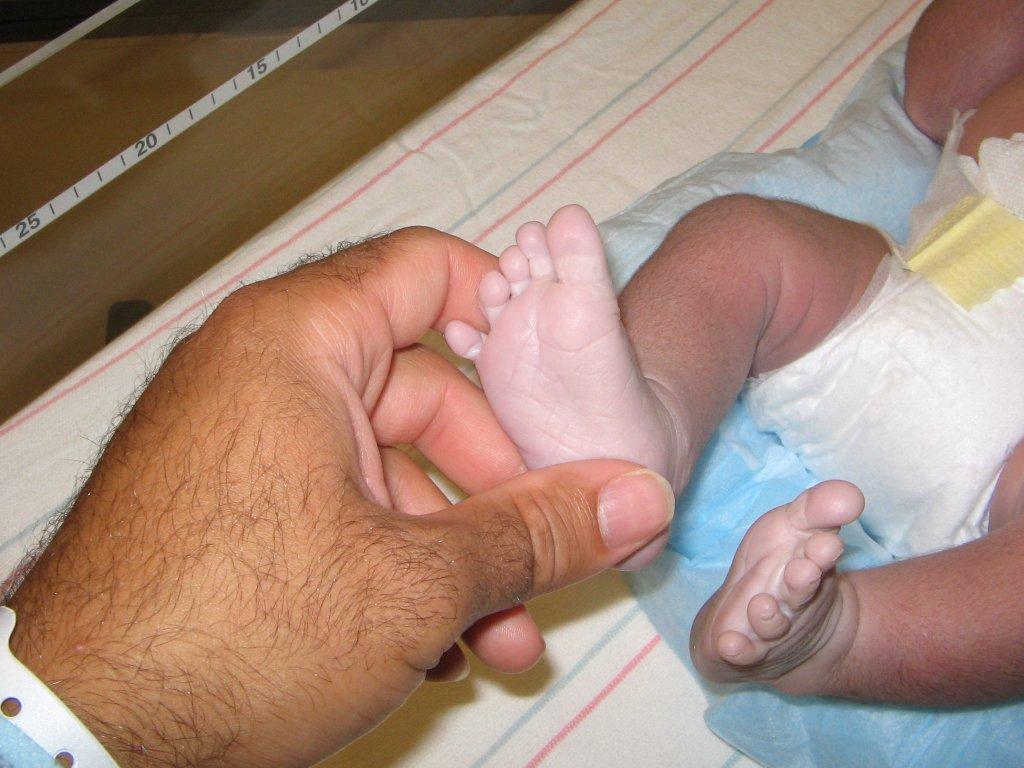 Асфиксия новорожденных - насколько она опасна для малыша?