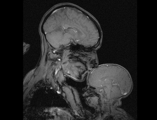 Материнскую любовь запечатлели на МРТ