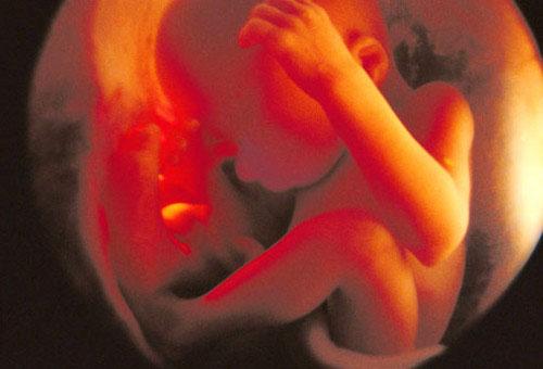Culoarea lichidului amniotic: ce semnifică aceasta?