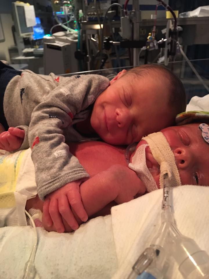 Gest emoționant! Ce a făcut un bebeluș sănătos lângă fratele lui geamăn, aflat în stare gravă