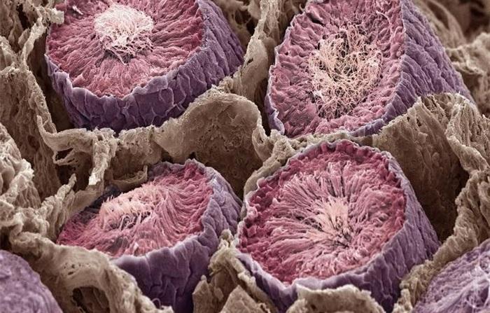 18 fotografii uimitoare: Cum arată organele noastre la microscop