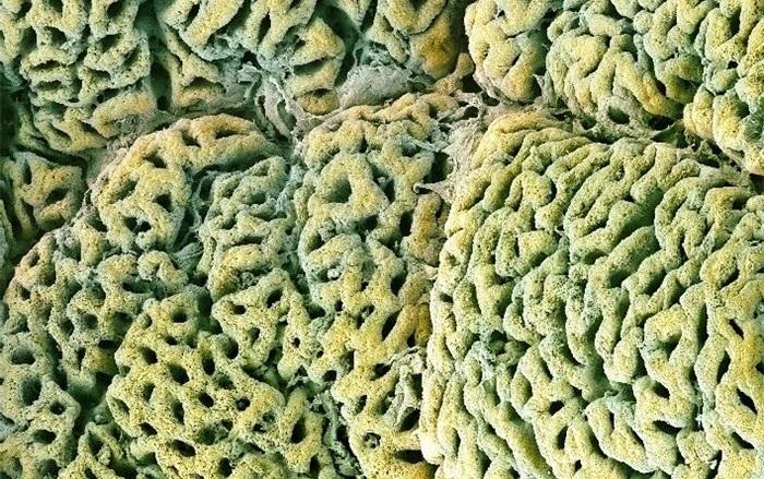 18 fotografii uimitoare: Cum arată organele noastre la microscop