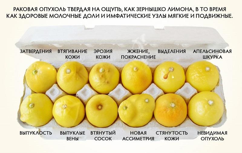 Как распознать признаки рака молочной железы? «Вирусное» изображение, которое спасло жизнь женщине