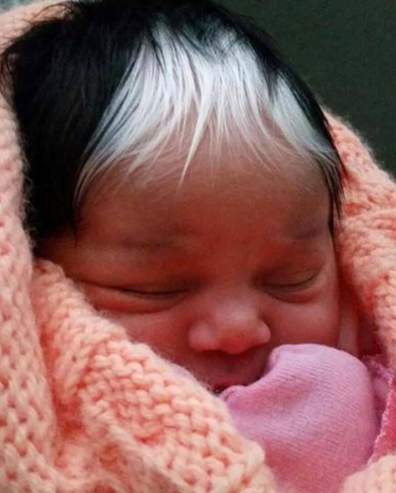 În SUA s-a născut o fetiță neobișnuită! S-a dovedit că nu este primul caz în istorie