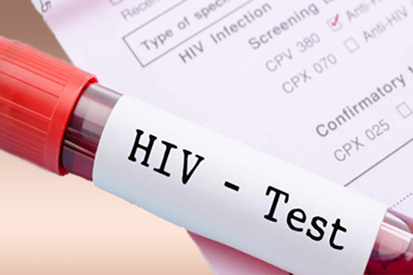 Сегодня кишиневцы смогут бесплатно пройти тестирование на ВИЧ