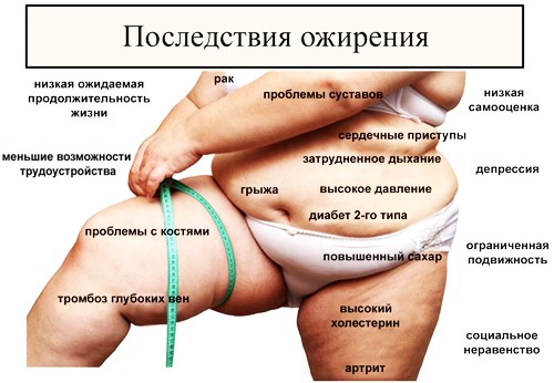 Ожирение: Причины и решение проблемы