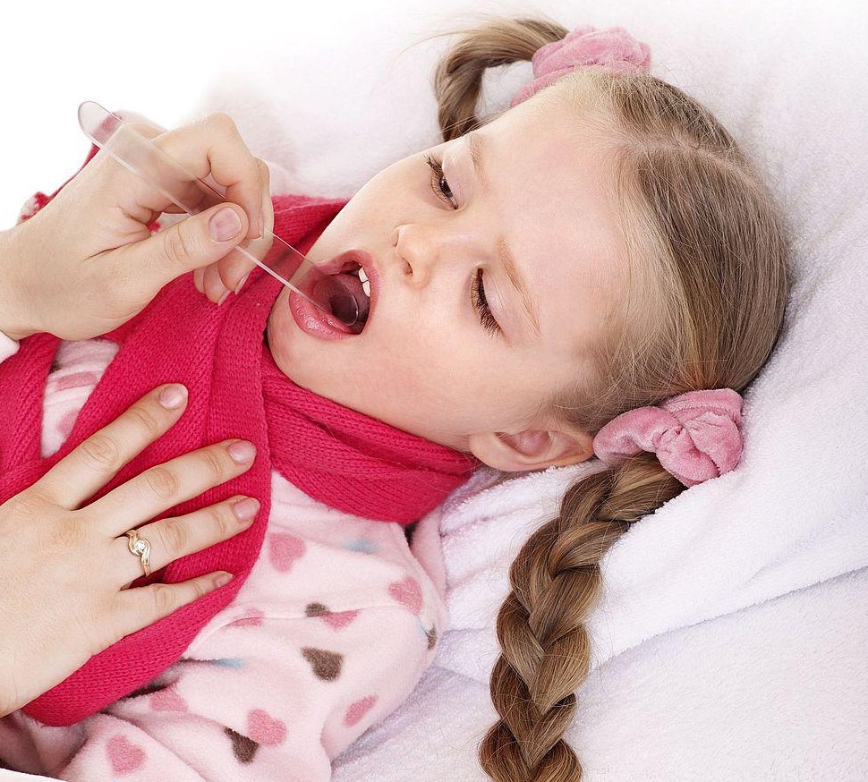 Ангина у детей: симптомы и лечение