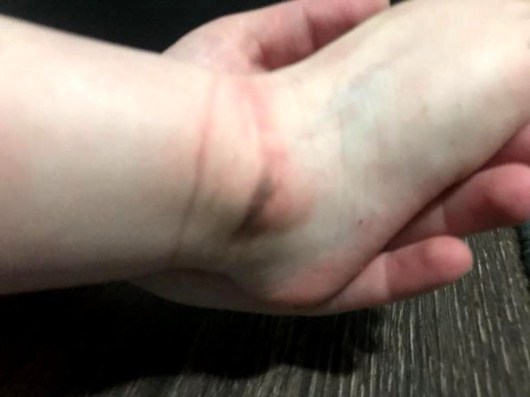 Cum a fost torturată o fetiță care obișnuia să se descalțe la grădiniță