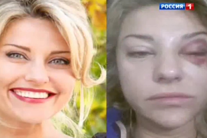 Жена Башарова впала в кому после избиения мужем