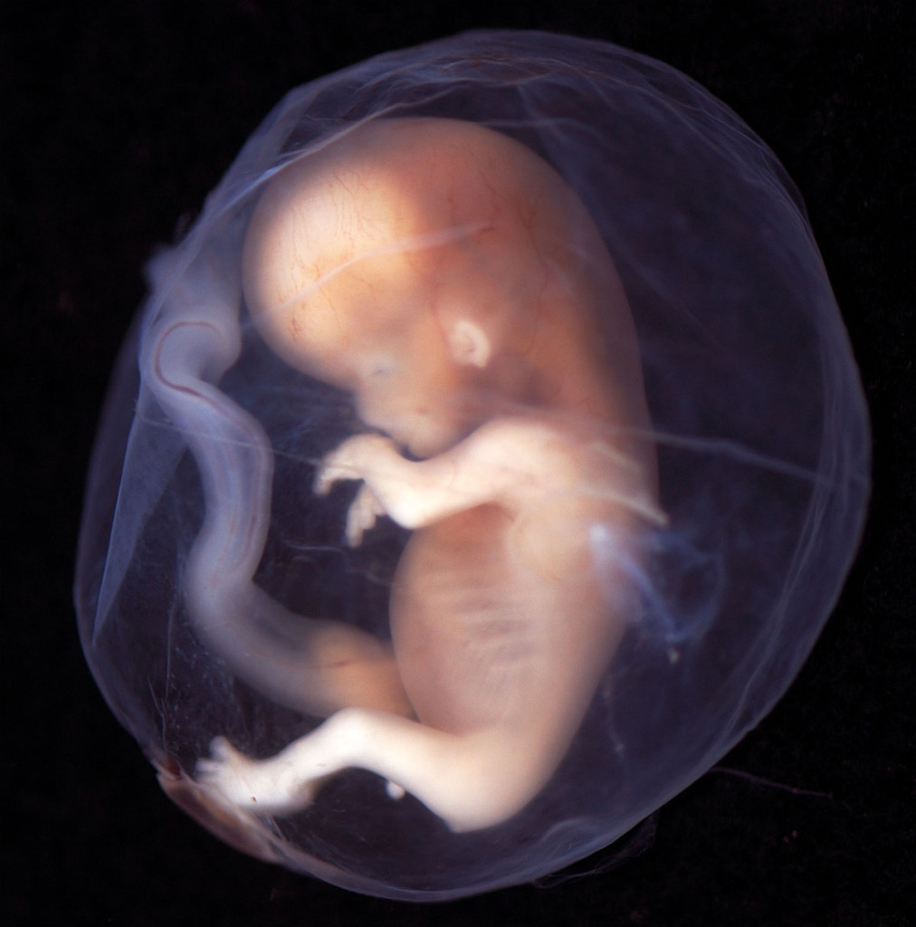 Lichidul amniotic – ce reprezintă?