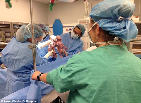 Родившиеся двойняшки привели в умиление весь медицинский персонал
