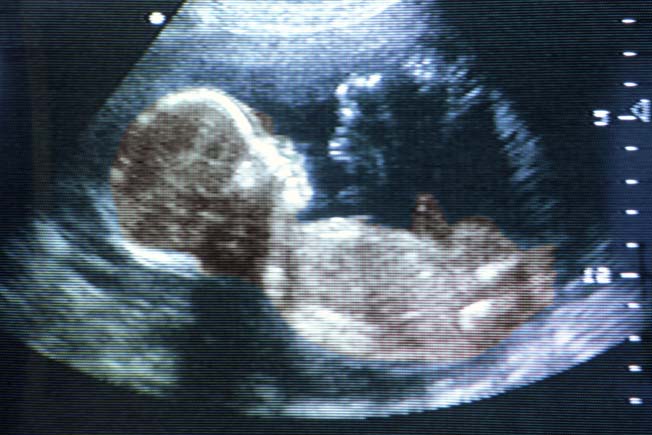 Feodosie Bejan. Posibilitățile metodelor sonografice contemporane în timpul sarcinii