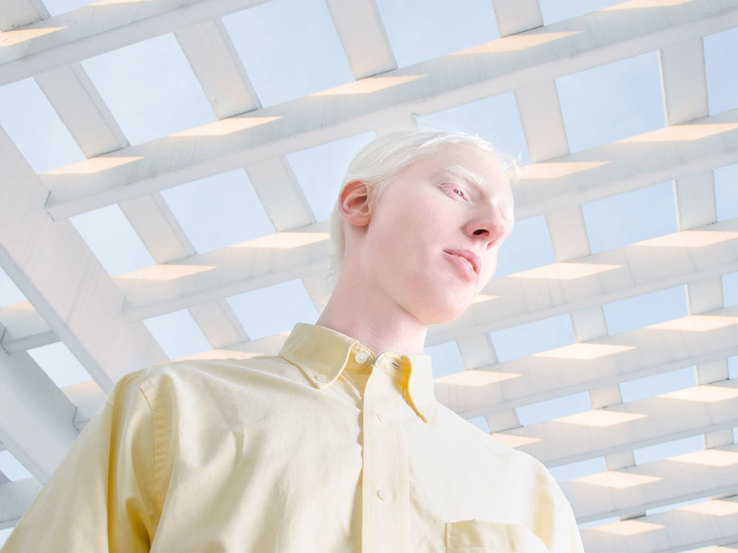 Альбиносы стали героями фотопроекта, чтобы изменить отношение к себе