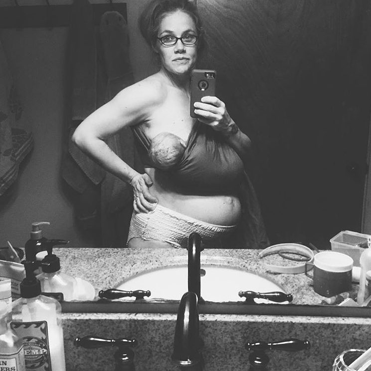 Fotografia de unei proaspete mame trădează imaginea reală a femeii după naștere