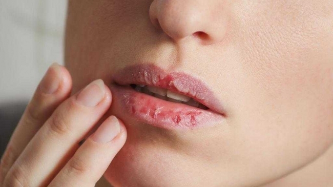 Почему люди кусают губы и щеки