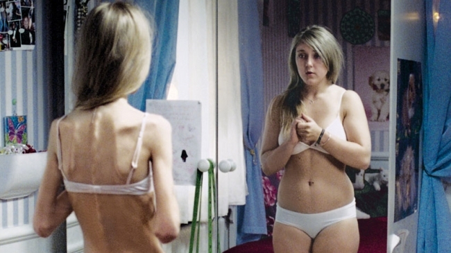 La ce raport de greutate la înălțime este diagnosticată anorexia?